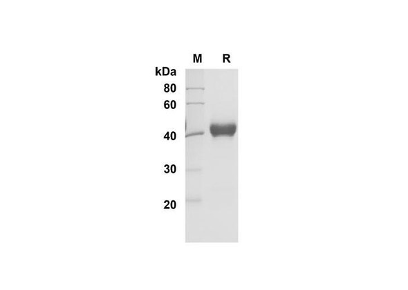 Recombinant Human IL-5 Protein (Fc Tag) (RPES8339)
