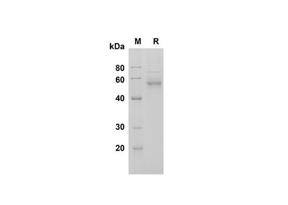 Recombinant Human Fetuin B Protein (His Tag) (RPES8350)