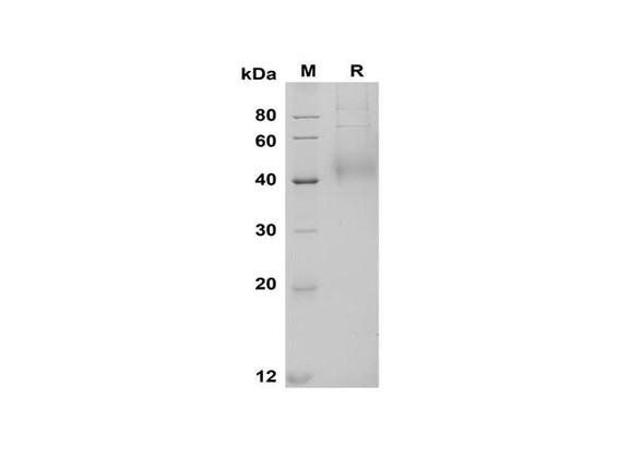 Recombinant Human TFPI Protein (His Tag) (RPES8381)