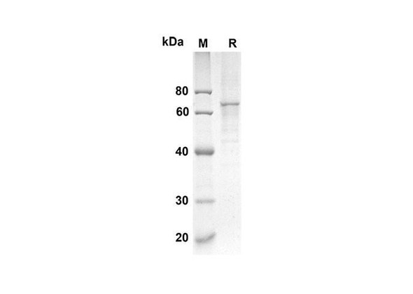 Recombinant Mouse CRTAM Protein (His Tag) (RPES8426)