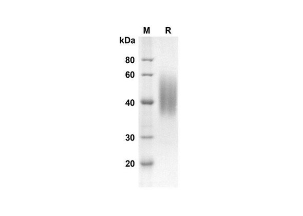 Recombinant Mouse CD86 Protein (His Tag) (RPES8432)
