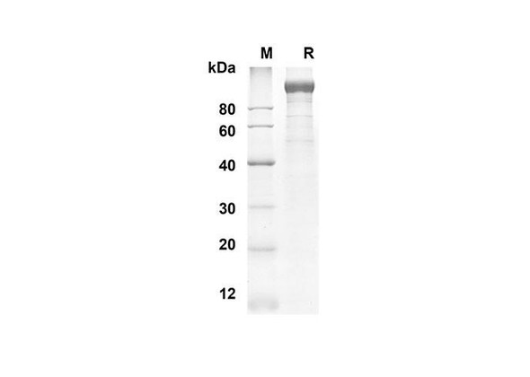 Recombinant Mouse LEPR Protein (His Tag) (RPES8443)