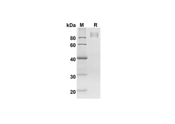 Recombinant Mouse AXL/UFO Protein ( Fc Tag) (RPES8450)