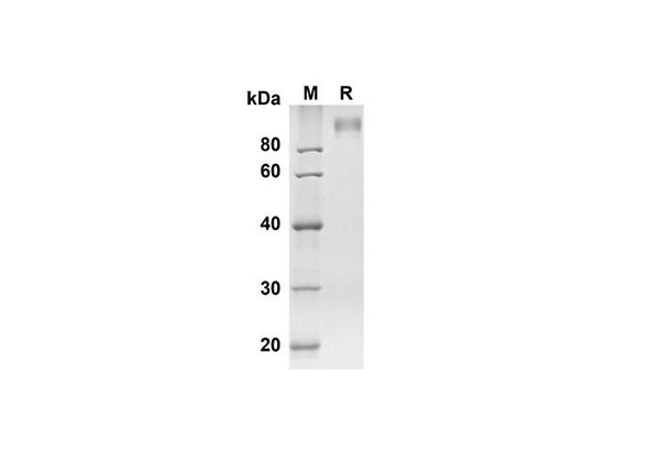 Recombinant Mouse Adgre5 Protein ( Fc Tag) (RPES8453)