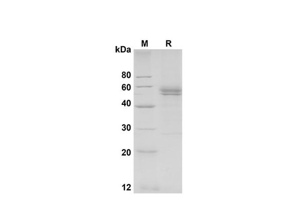 Recombinant Mouse BLAME/SLAMF8 Protein (Fc Tag) (RPES8460)