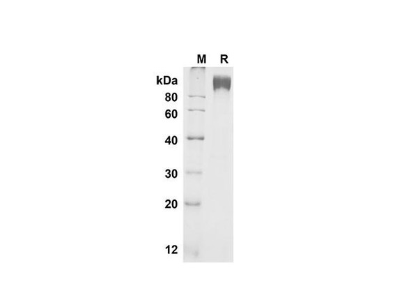 Recombinant Mouse M-CSF R/CD115 Protein (Fc Tag) (RPES8461)