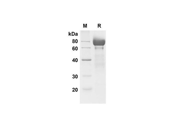 Recombinant Mouse Fetuin A/AHSG Protein (Fc Tag) (RPES8466)