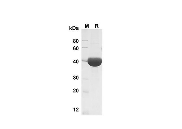 Recombinant Mouse Chitinase 3-like 1 Protein (His Tag) (RPES8478)