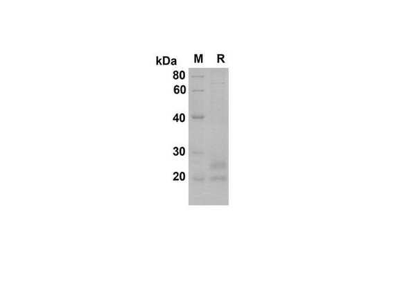 Recombinant Mouse BAFF R/TNFRSF13C Protein (His Tag) (RPES8489)