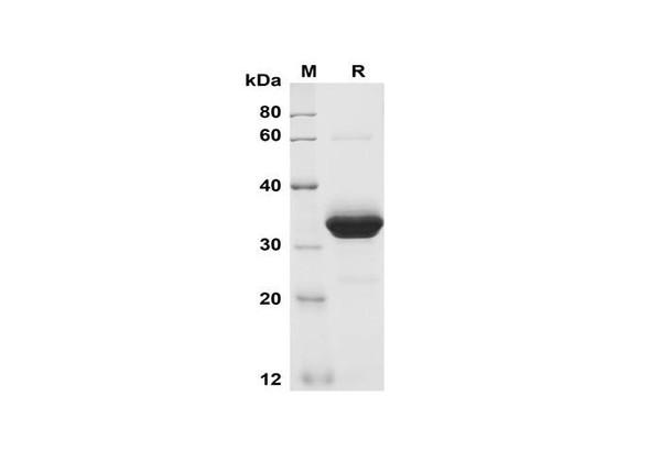 Recombinant Mouse Cripto-1 Protein (Fc Tag) (RPES8500)