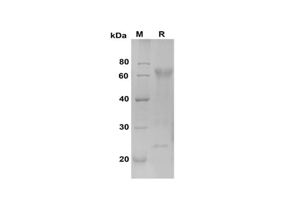 Recombinant Mouse Osteopontin/OPN Protein (His Tag) (RPES8511)
