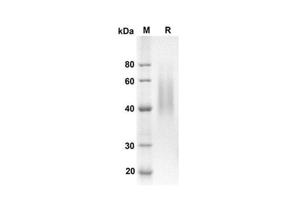 Recombinant Rat CD86 Protein (His Tag) (RPES8523)