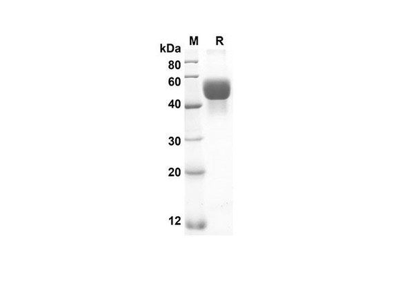 Recombinant Rat HP Protein (His Tag) (RPES8528)