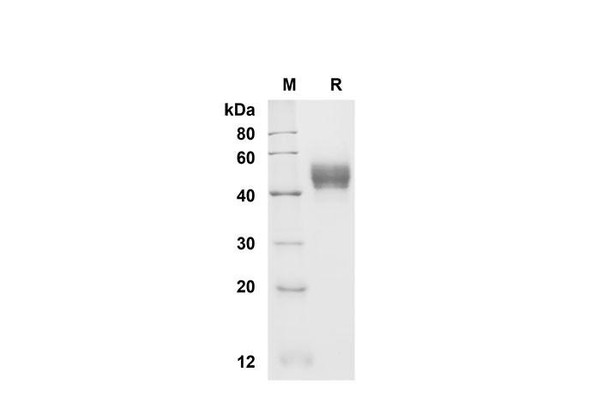 Recombinant Rat CD14 Protein (His Tag) (RPES8531)