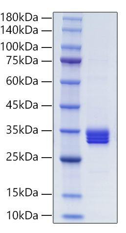 Recombinant Human IL-27/IL-27A&IL-27B Protein (RPCB0001)