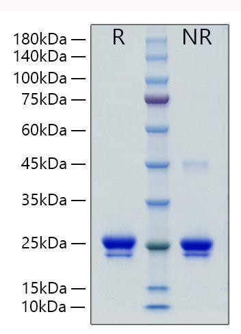 Recombinant Human Lipocalin-2/NGAL/LCN2 Protein (RPCB0006)