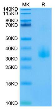 Biotinylated Recombinant Human Angiopoietin-like 3/ANGPTL3 (17-219) Protein (RPCB0030)