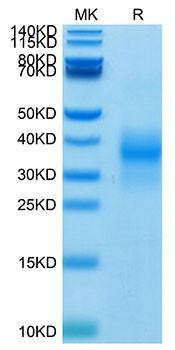 Biotinylated Recombinant Human NKG-2D/KLRK1/CD314 Protein (RPCB0049)