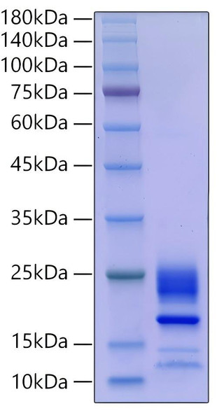 Recombinant Mouse IL-21 Protein (RPCB0099)