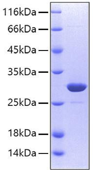 Recombinant Human Carbonic anhydrase 2 Protein (RPCB0139)