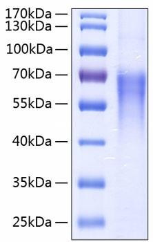Recombinant Human B7-2/CD86 Protein (RPCB0191)