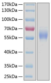 Recombinant Human DDR2/CD167b Protein (RPCB0206)