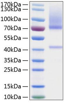 Recombinant Human Glypican-3/GPC3 Protein (RPCB0230)