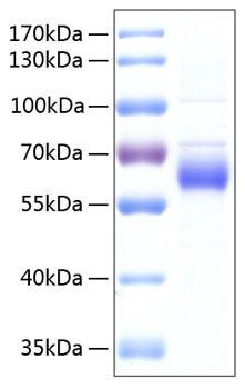 Recombinant Human FGFR-5/FGFRL1 Protein (RPCB0233)