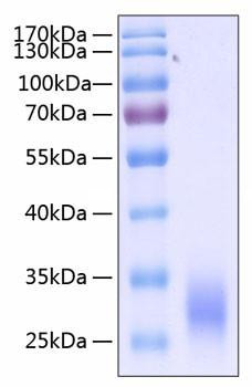 Recombinant Human Fc gamma RIIA/FCGR2A/CD32a (H167R) Protein (RPCB0275)