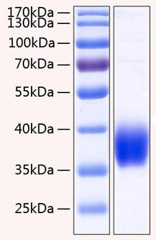Recombinant Human Carbonic anhydrase 12 Protein (RPCB0273)