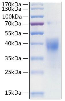 Recombinant Human IFN-gamma R1/CD119 Protein (RPCB0281)
