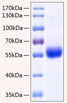 Recombinant Human TNFRSF11B/Osteoprotegerin Protein (RPCB0293)