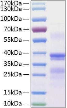 Recombinant Human RGMA Protein (RPCB0301)