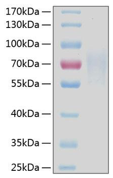 Recombinant Human TNFRSF8/CD30 Protein (RPCB0302)