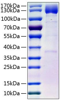 Recombinant Human PDGFR-beta/CD140b(E241D) Protein (RPCB0314)