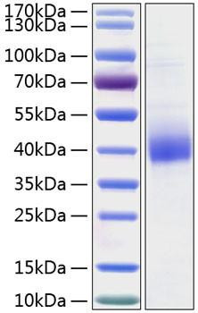 Recombinant Human CD301 Protein (RPCB0321)