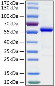 Recombinant Human Ephrin-A5/EFNA5 Protein (RPCB0330)