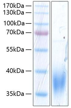 Recombinant Human SLAMF7/CRACC/CD319 Protein (RPCB0354)