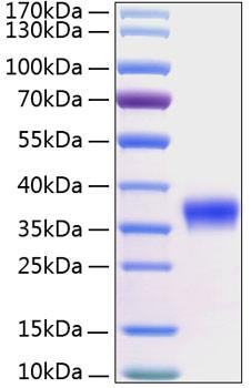 Recombinant Human Kallikrein-8/KLK8 Protein (RPCB0369)