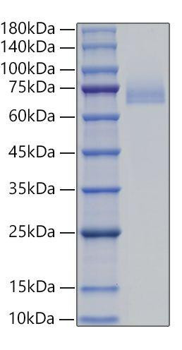 Recombinant Human DLL4 Protein (RPCB0440)