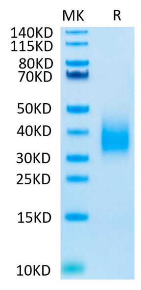 Biotinylated Recombinant Human TREM2 Protein (RPCB0503)
