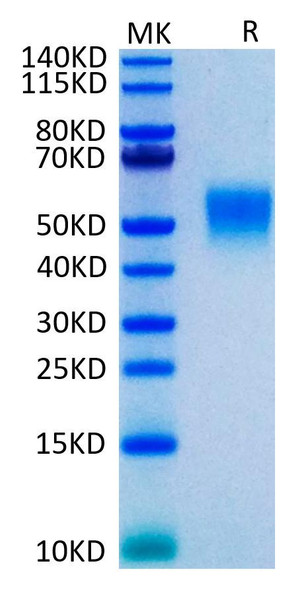 Recombinant Human TNFRSF1B/TNF-R2/CD120b Protein (RPCB0508)