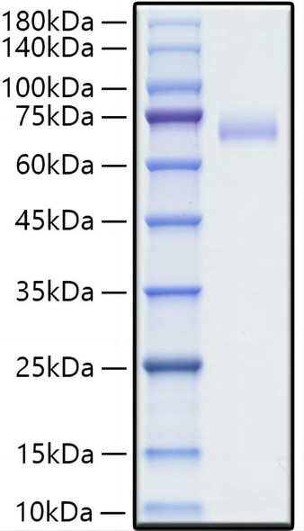 Recombinant Human SLAMF1/CD150 Protein (RPCB0521)