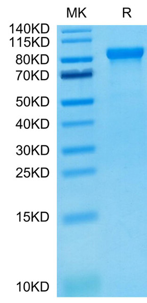Recombinant Human LILRB2/ILT-4/CD85d Protein (RPCB0527)