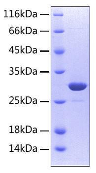 Recombinant Human TNFRSF11A/RANK/CD265 Protein (RPCB0547)