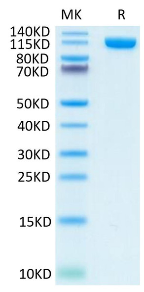 Recombinant Human PSMA/FOLH1 Protein (RPCB0611)