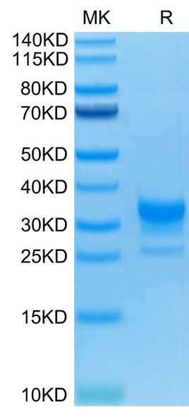 Recombinant Human Fc gamma RIIB/FCGR2B/CD32b Protein (RPCB0627)