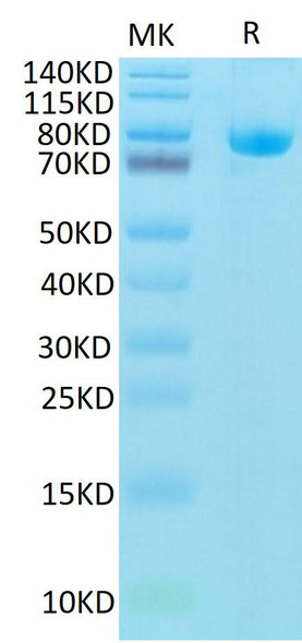 Biotinylated Recombinant Human CD5 Protein (RPCB0652)