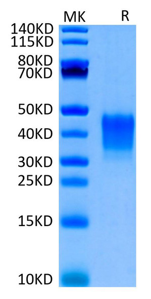 Biotinylated Recombinant Human CD7 Protein (RPCB0690)