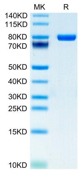 Recombinant Human CD5 Protein (RPCB0692)